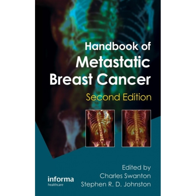 Handbook of Metastatic Breast Cancer, Second Edition